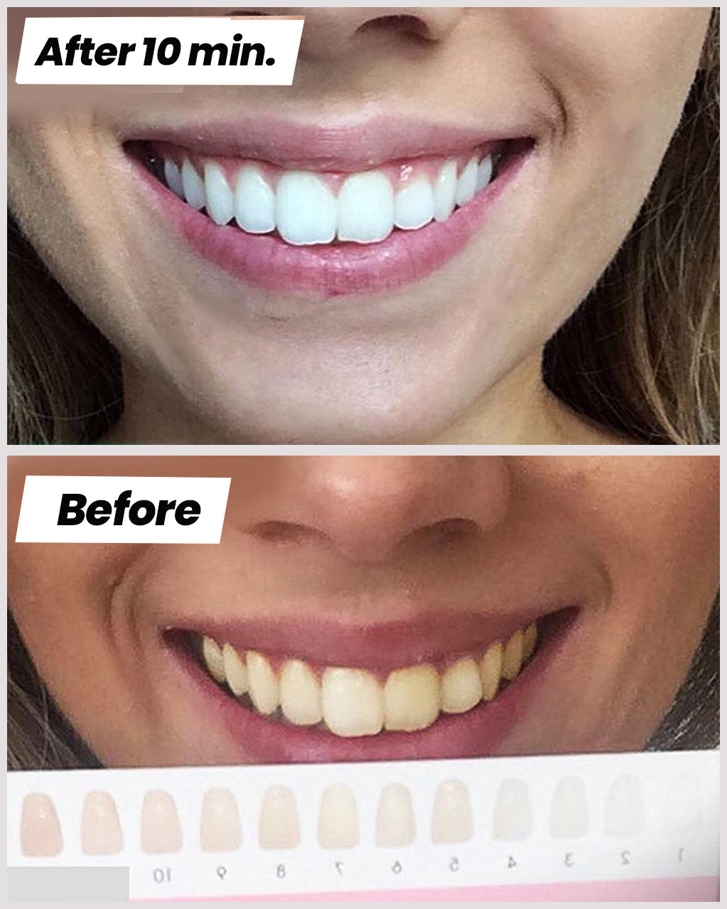 Teeth Whitening Set - clicksmile.net